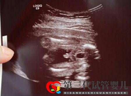 求锦鲤、望翻盘，想生男孩的她们有多努力？(图1)