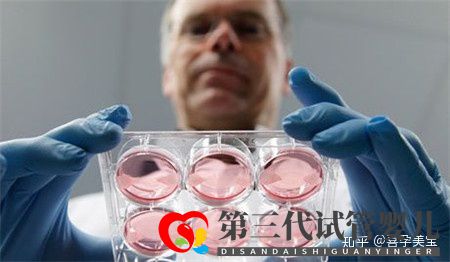 掌控这三点,高龄女性做试管婴儿成功率将达100%(图4) 掌控这三点,高龄女性做试管婴儿成功率将达100%(图4)
