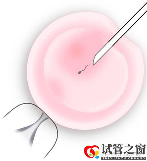 关于试管婴儿,你想知道的都在这里,不懂就得多看看(图2) 关于试管婴儿,你想知道的都在这里,不懂就得多看看(图2)