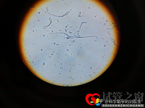 做试管婴儿的全过程做三代试管婴儿预备10万够不够(图7) 做试管婴儿的全过程做三代试管婴儿预备10万够不够(图7)