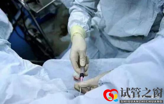直击试管婴儿的过程(图5) 直击试管婴儿的过程(图5)