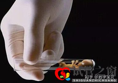 靠试管婴儿生宝宝首先要满足6个标准(试管婴儿怎么做的全过程)(图1) 靠试管婴儿生宝宝首先要满足6个标准(试管婴儿怎么做的全过程)(图1)