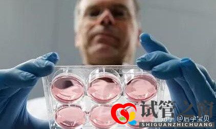 靠试管婴儿生宝宝首先要满足6个标准(试管婴儿怎么做的全过程)(图3) 靠试管婴儿生宝宝首先要满足6个标准(试管婴儿怎么做的全过程)(图3)