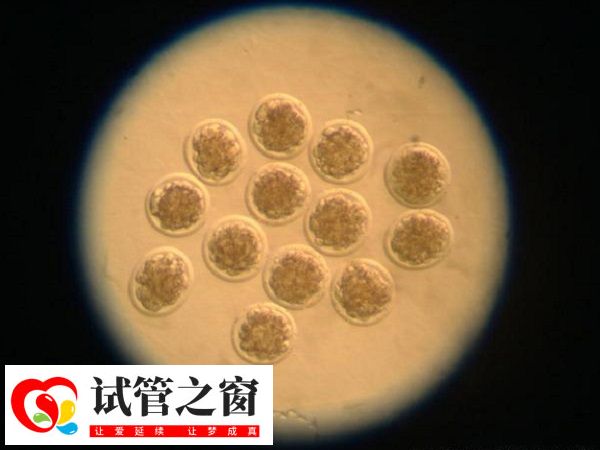 胚胎的等级评估主要依据胚胎的发育阶段