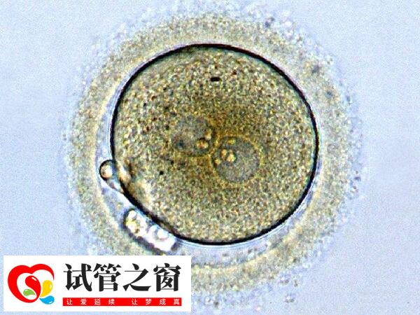 4BB囊胚移植成功率影响因素多