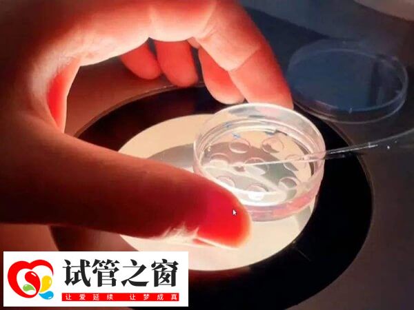 移植4ca囊胚并不会降低成功率