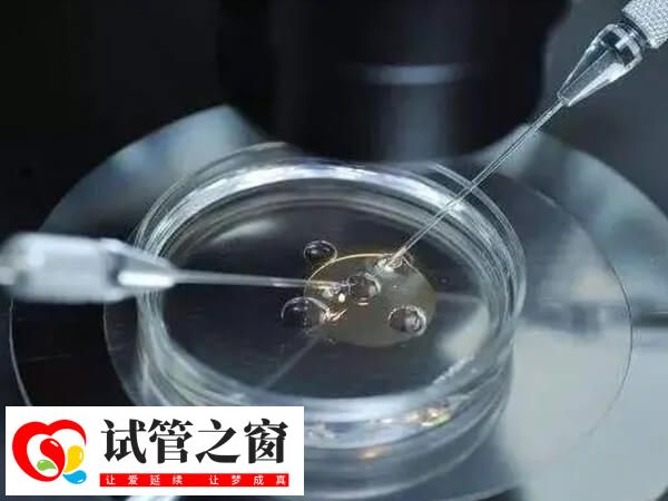 试管婴儿就是将精子和卵子拿到体外结合