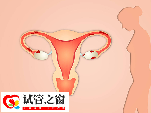 子宫内膜充血不能直接进行移植