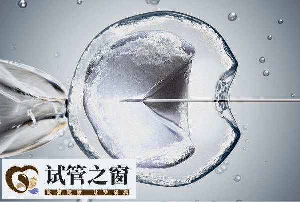 人工授精促排卵过程很简单