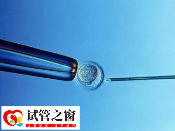 试管婴儿成功率在50%左右